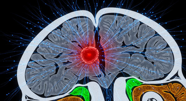 One Head Impact Electrifies An Entire Half Of Your Brain